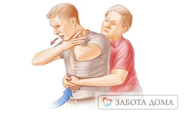Как спасти человека при удушье
