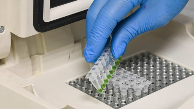 v-rossii-razrabotali-dnk-chip-diagnostirujushhij-bolezni-po-kaple-krovi-e82c382.jpg