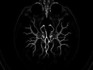 Как работает взгляд внутрь: магнитно-резонансная томография внутренних органов без страха и мистики