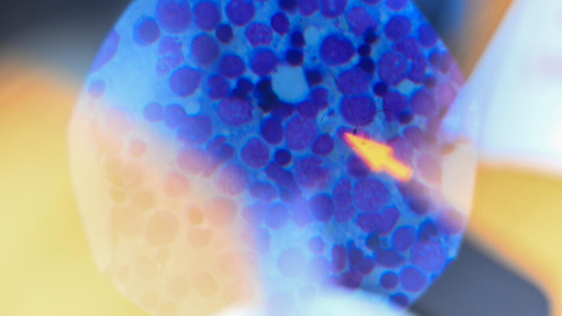 Органы свиньи в теле человека: ученые столкнулись с шокирующим открытием