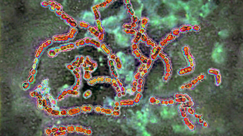 Органы свиньи в теле человека: ученые столкнулись с шокирующим открытием